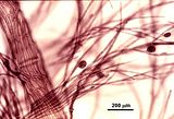 5 - Tetrasporofito con tetrasporocisti